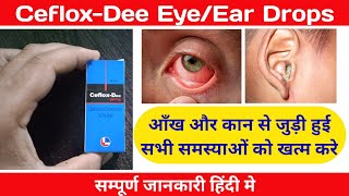 CefloxDee eye dropCefloxDee Ear dropCiprofloxacin amp Dexamethasone EyeDear drops [upl. by Nomrah]