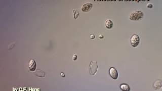 Time lapse of grape downy mildew pathogen Plasmopara viticola [upl. by Laon]