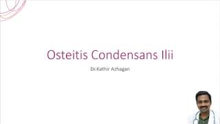 Osteitis Condensans Ilii  DrKathir Azhagan orthomechanic [upl. by Urbannai403]