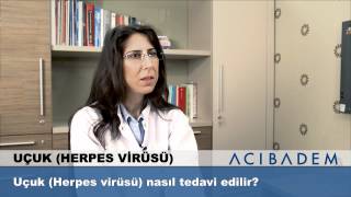 Uçuk Herpes Virüsü nasıl tedavi edilir [upl. by Otreblasiul]