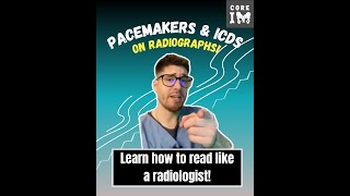 Pacemaker vs implantable cardiac defibrillator on xray Lets learn to read like a radiologist [upl. by Haletta]