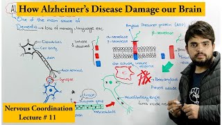 Alzheimers Disease [upl. by Eentruoc133]