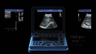 CONTEC ultrasound Scanner Doppler CMS600P2 PLUS [upl. by Prentice141]