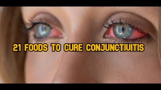 21 Foods to cure conjunctivitis [upl. by Ariet838]