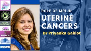 ROLE OF MRI IN ENDOMETRIAL CANCER  DR PRIYANKA GAHLOT [upl. by Anitserp]