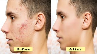 quotHow to skin retouching in Adobe Photoshopquot [upl. by Remington97]