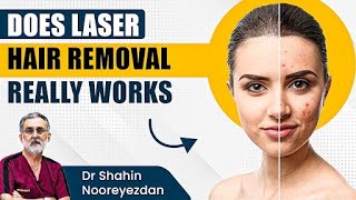 Does Laser Hair Removal Really Works  Laser Hair Removal Process  Apollo Hospital Delhi [upl. by Routh]