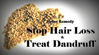 How To Stop Hair Loss and Treat Dandruff At Home Treatment and make hair grow long really fast [upl. by Modeste186]