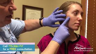 Acne Cyst Drainage Surgery for Cystic Acne  Reno Sparks MedSpa  Dr Calvin Van Reken [upl. by Haimerej]