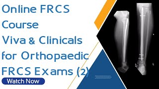 Online FRCS Course  Viva amp Clinicals for Orthopaedic FRCS Exams 2 wwwOrthopaedicAcademycouk [upl. by Cordeelia592]