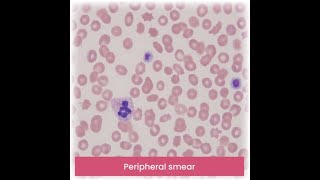 Reporting a Peripheral Blood Film or Blood smear Important things to note [upl. by Reede]