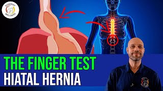 The Finger Test For Hiatal Hernia [upl. by Gney]