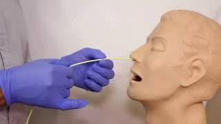 Nasogastric NG Tube Insertion OSCE Guide YouTube [upl. by Nosniv]