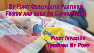 My First Oxaliplatin Platinum Fusion and back on Capecitabine [upl. by Anetsirhc]