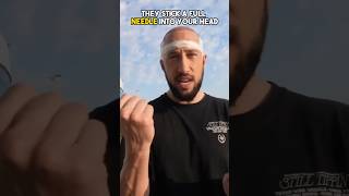 I Got a 2000 Hair Transplant in Turkey  Surgeon Reacts [upl. by Anavlis]