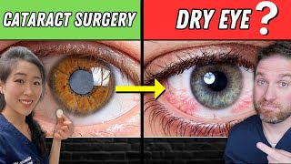 Dry Eyes After Cataract Surgery Causes And Tips To Help [upl. by Emelia310]