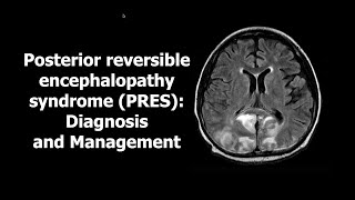 Posterior reversible encephalopathy syndrome [upl. by Oidivo]