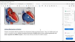 Plab 1 Lectures Psychiatry Part 7 Lithium Part 2Schizophrenia Features [upl. by Mckenna73]