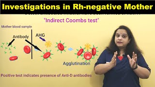 Investigations in Rhnegative mother  Rh Incompatibility  Nursing Lecture [upl. by Ressler214]