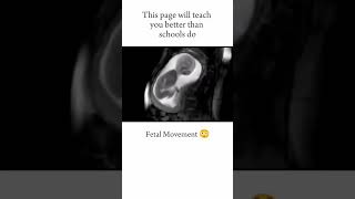 FETAL MOVEMENT😃 short youtubeshorts medical neet [upl. by Harv]