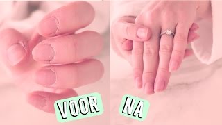 Snel droge handen en nagelriemen verzorgen  Beautygloss [upl. by Dagmar]