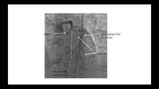 Coronary angiographic views Elias Hanna [upl. by Ylrehc823]