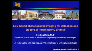 Acoustic X3 LEDbased photoacoustic imaging for detection and staging of inflammatory arthritis [upl. by Winther943]