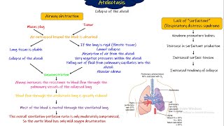 Atelectasis Respiratory Physiology Chapter 43 part 4 Guyton and Hall Physiology [upl. by Porett]