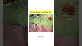 saline irrigation in nasal Allergies anatomy 3Dstructure biology pharmacy shorts viral nasal [upl. by Idnib]