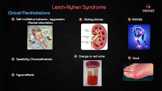 LeschNyhan syndrome  Usmle step 1 Biochemistry Case Based discussion [upl. by Brookhouse]