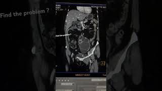 ct urography radiology ctscan [upl. by Nagram]