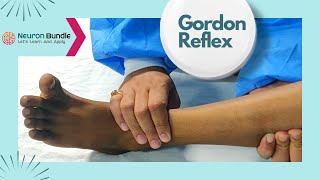 Gordons Reflex alternative to Babinskisign cns neurology extensorplantar medschool [upl. by Carla]