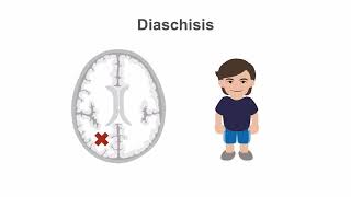 Occipital Lobes Overview Lesions amp Clinical Significance [upl. by Eastlake]