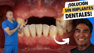 ¿Te faltan dientes y no quieres implantes Solución asequible  Dentadura removible [upl. by Ycam]