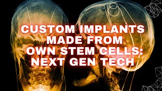 Custom implants made from patients stem cells Next Gen Tech [upl. by Archie939]