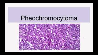 Pheochromocytoma [upl. by Aneerak931]