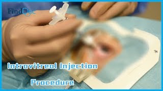 Intravitreal Injection Procedure Demonstration  Dr Yip Pui Pui 眼球注射示範教學影片  葉佩珮眼科專科醫生 [upl. by Anitneuq]