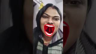 💋🤣🤣🤣🤣comedy dentist 歯医者さん funny [upl. by Ricardo405]