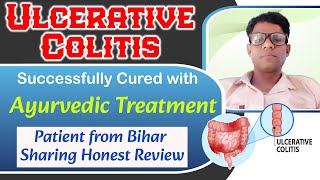 Ulcerative Colitis Ayurvedic Treatment Successfully Cured Patient From Bihar Sharing Honest Review [upl. by Gregoire]