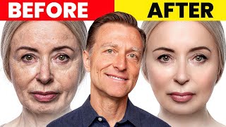 The Ultimate Face Transformation–Dr Bergs Best Remedy for Dry Skin and Wrinkles [upl. by Kelvin]