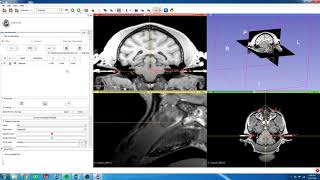 7 3D Slicer  Translate Stereotaxic Origin to 3D Slicer Origin [upl. by Rann]