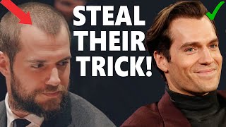 Top 5 Actors Who Are Receding Hairline Masters Steal their 4 key tricks [upl. by Nert]