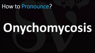 How to Pronounce Onychomycosis CORRECTLY [upl. by Rattan]