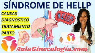 SÍNDROME DE HELLP CAUSAS DIAGNÓSTICO TRATAMIENTO PARTO  Ginecología y Obstetricia [upl. by Ofella]