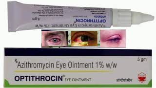 Optithrocin Eye Ointment [upl. by Aerdnak]