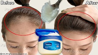 How to use Vaseline for double hair growth your hair will grow 3 times faster [upl. by Attenrad]