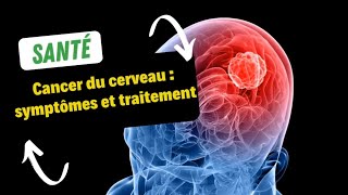 Cancer du cerveau  symptômes et traitement [upl. by Ellenwad895]