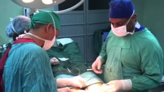 Se quitan las estrias con la abdominoplastia [upl. by Shanon415]