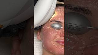 ASMR Laser Treatment [upl. by Carl]