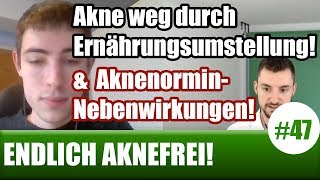 AKNE WEG Christian über Aknenormin amp Nebenwirkungen Ernährung uvm ENDLICH AKNEFREI 47 [upl. by Landrum]